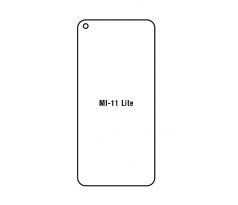 Hydrogel - Privacy Anti-Spy ochranná fólia - Xiaomi Mi 11 Lite/Mi 11 Lite 5G