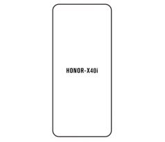 Hydrogel - ochranná fólia - Huawei Honor X40 (case friendly)