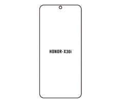 Hydrogel - ochranná fólia - Huawei Honor X30 Max (case friendly)