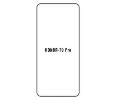 Hydrogel - ochranná fólia - Huawei Honor 70 Pro (case friendly)