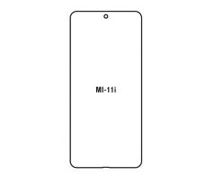 Hydrogel - ochranná fólia - Xiaomi Mi 11i (case friendly)