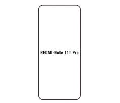 Hydrogel - ochranná fólia - Xiaomi Redmi Note 11T Pro (case friendly)
