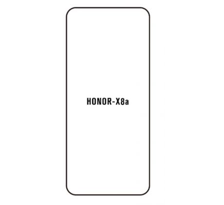 Hydrogel - ochranná fólia - Huawei Honor X8a (case friendly) 
