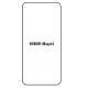 Hydrogel - ochranná fólia - Huawei Honor Magic5 