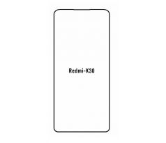 UV Hydrogel s UV lampou - ochranná fólia - Xiaomi Redmi K30 Ultra