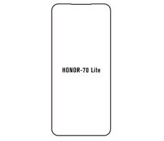 Hydrogel - ochranná fólia - Huawei Honor 70 lite
