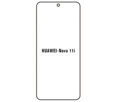 Hydrogel - matná ochranná fólia - Huawei Nova 11i