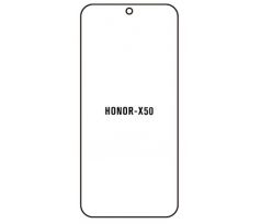 Hydrogel - ochranná fólia - Huawei Honor X50 (case friendly) 
