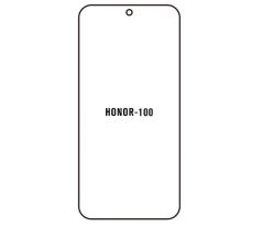 Hydrogel - ochranná fólia - Huawei Honor 100 (case friendly)  