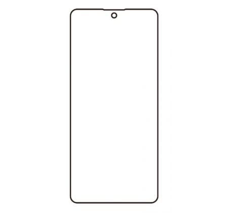 Hydrogel - ochranná fólia - Xiaomi Poco X6 (case friendly)