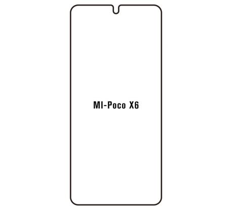 Hydrogel - Privacy Anti-Spy ochranná fólia - Xiaomi Poco X6